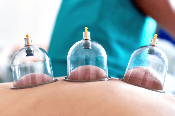 Dry Cupping
